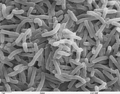 244px-Cholera_bacteria_SEM