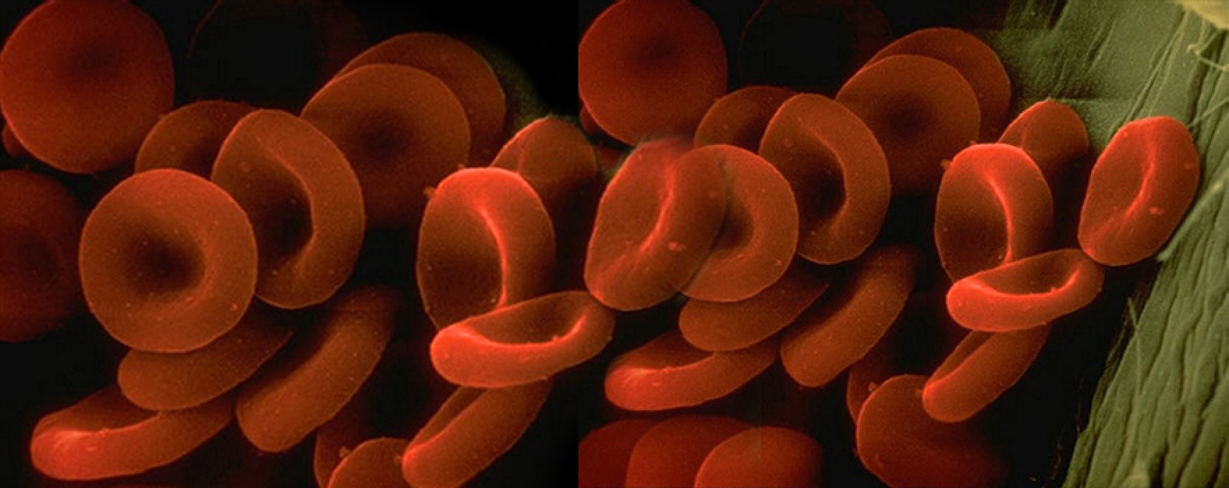 Kana Kırmızı Rengini Veren Hücreler: Alyuvarlar